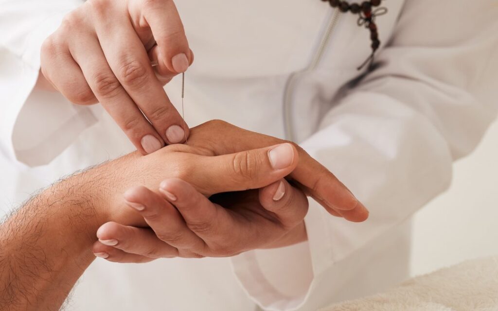 How Does Acupuncture Benefit Your Health in Philadelphia