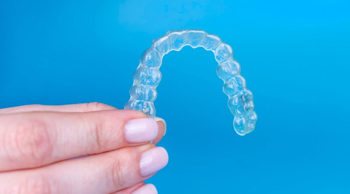 Clear Aligners