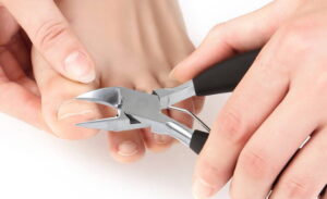 Best nail scissors for ingrown toenails in New York