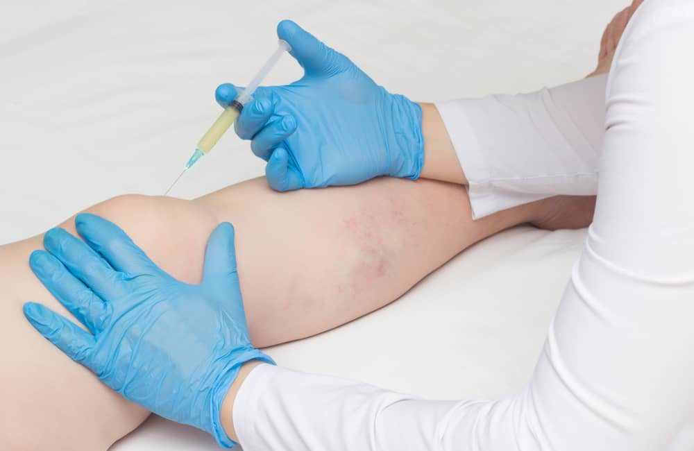 Knee Pain doctor Fidi