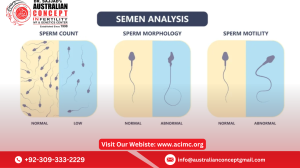 Azoospermia Treatment