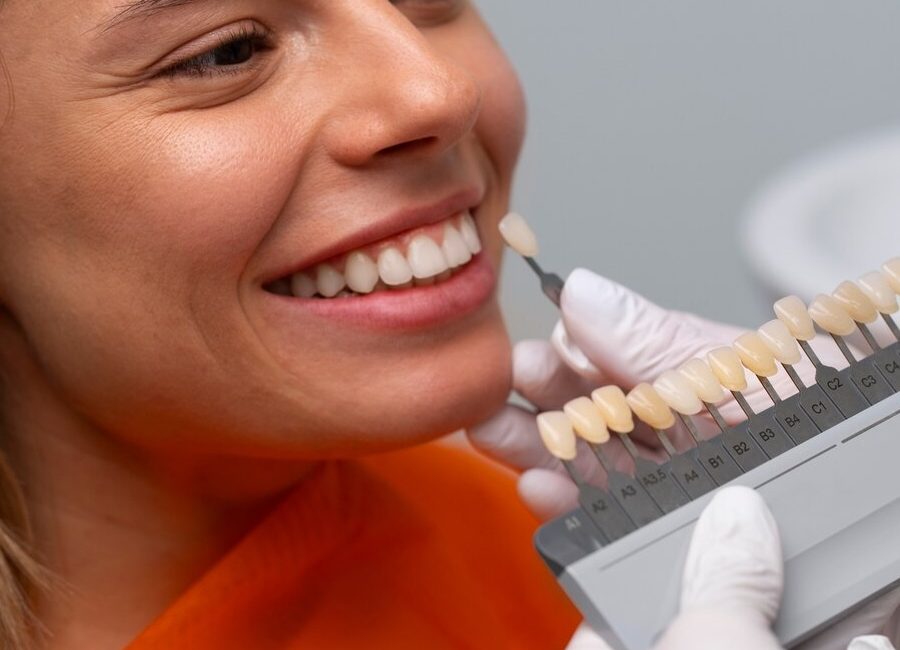 teeth whitening Dubai