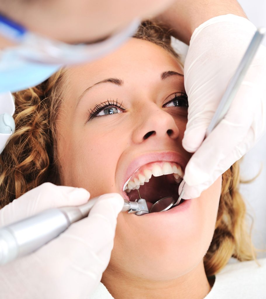 houston texas veneers