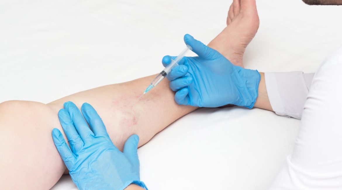 what does a vein clinic do