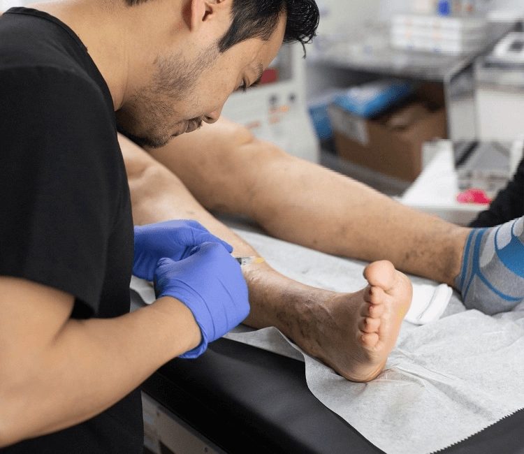 what are the treatment options for varicose veins