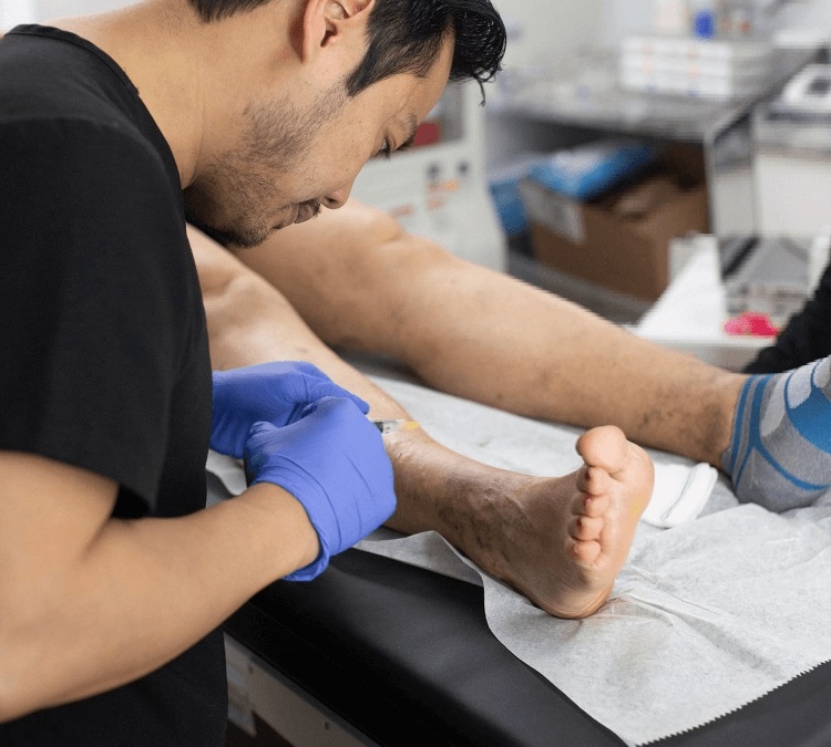 what are the treatment options for varicose veins