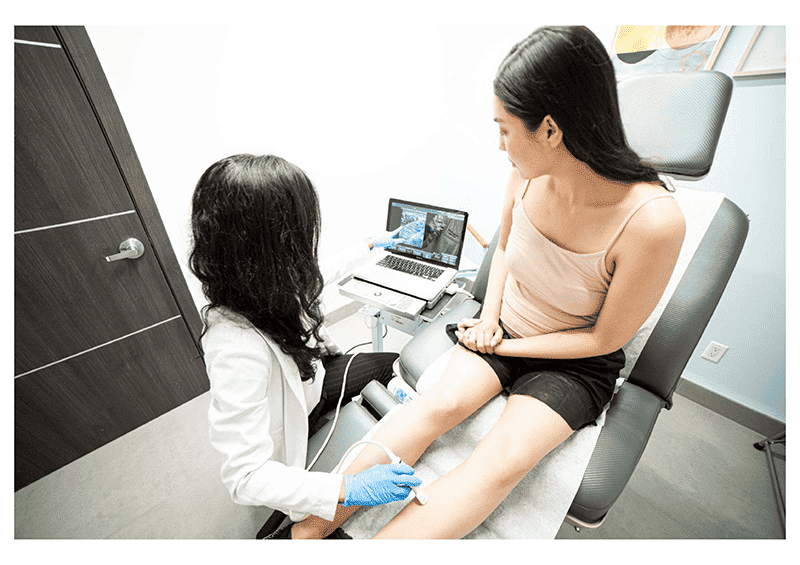 what are the treatment options for varicose veins