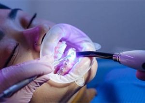 dentist for braces near me