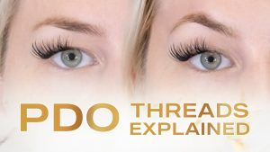 PDO Threads treatment at SF Aesthetic Medspa in Bourbonnais IL for natural face lift results