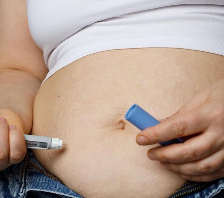 mounjaro injection in islamabad