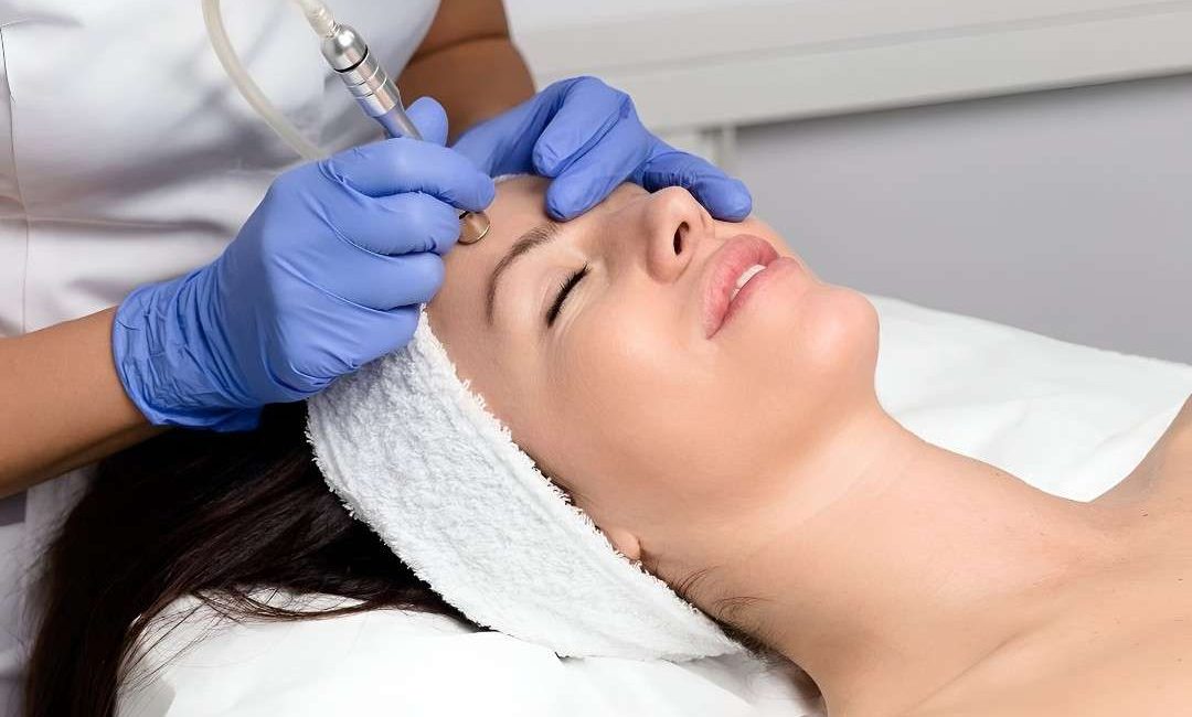 microdermabrasion in islamabad