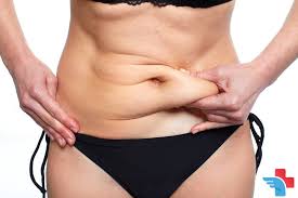 Bariatric Surgery in Islamabad