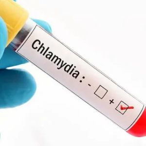 Chlamydia Test in Dubai