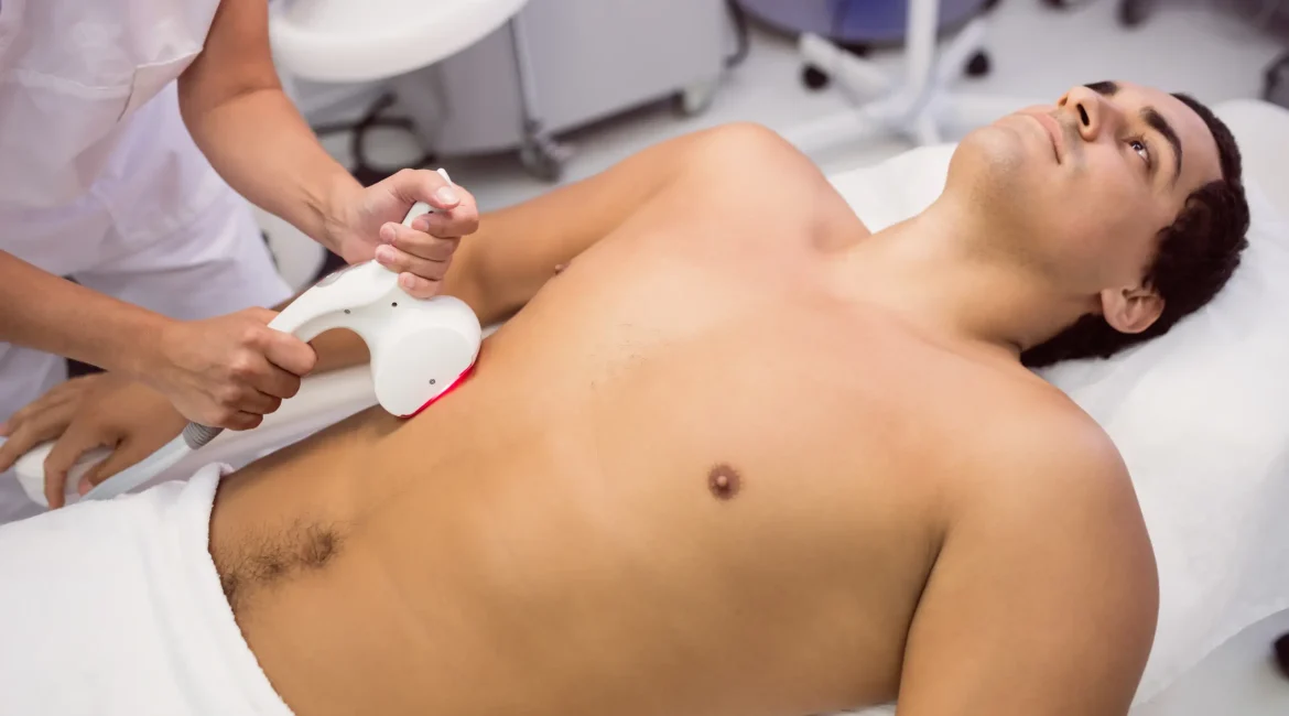 Toronto laser hair removal