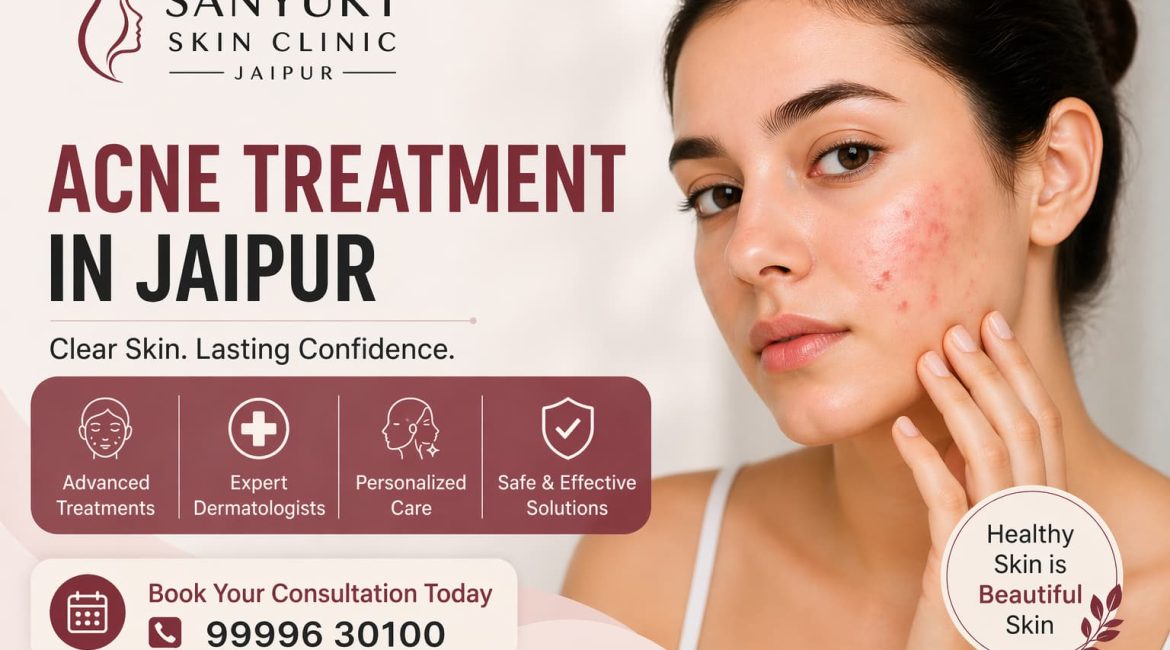 Acne Treatment in Jaipur