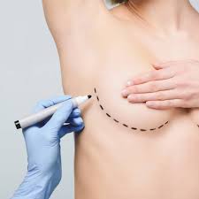 Breast Augmentation in Islamabad