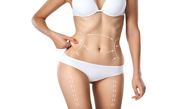 Bodytite Liposuction in Riyadh