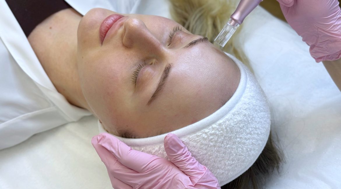 Dermapen treatment in Islamabad