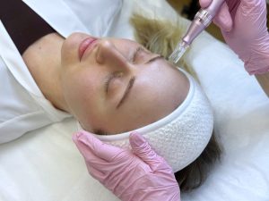 Dermapen treatment in Islamabad