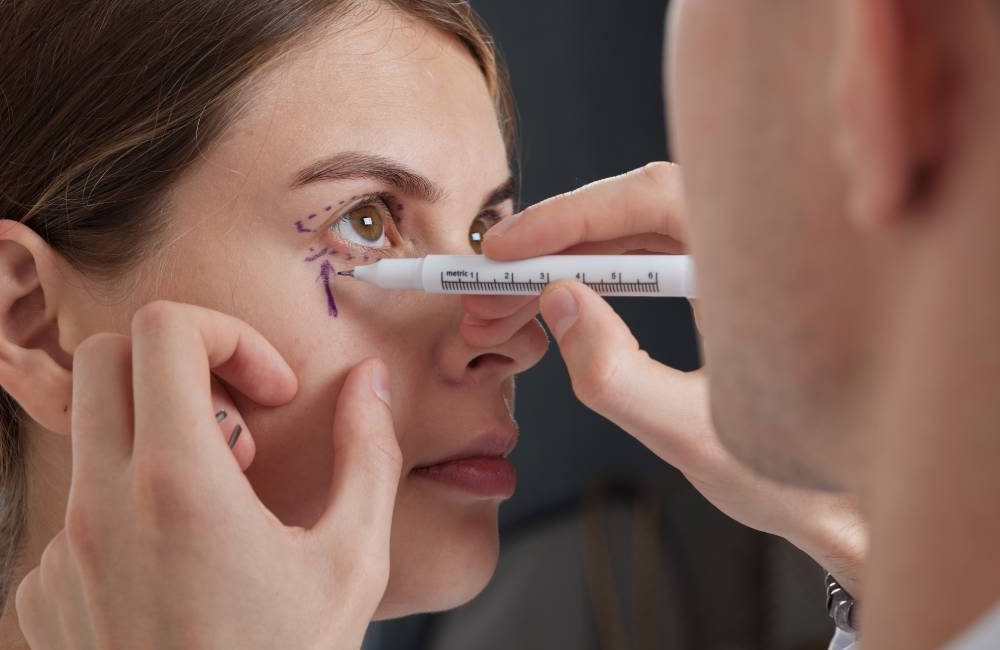Eyelid surgery in Islamabad