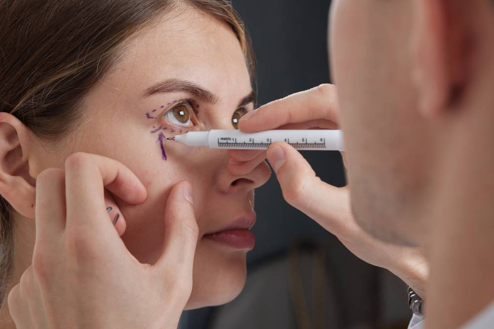 Eyelid surgery in Islamabad