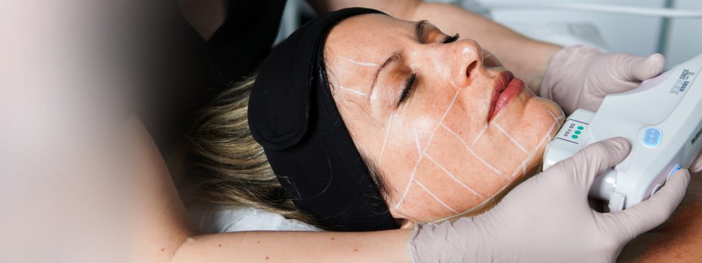 Ultherapy Treatment in Islamabad