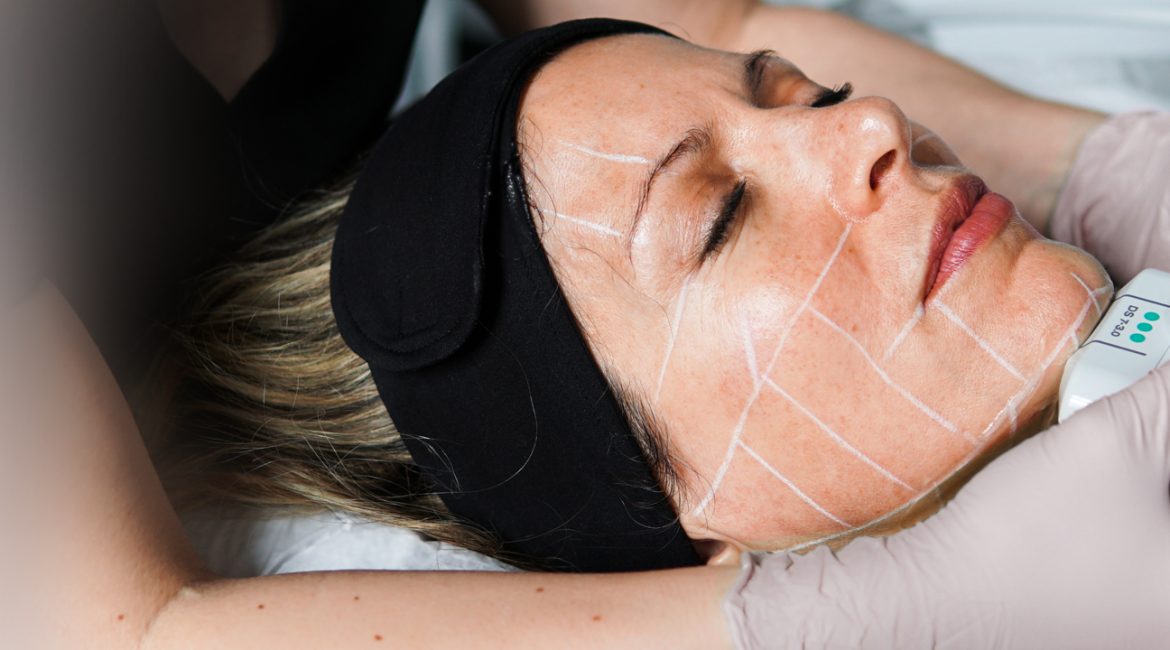Ultherapy Treatment in Islamabad